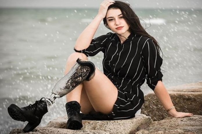 Chiara Bordi, la primera Miss Italia que desafía al mundo con una pierna biónica