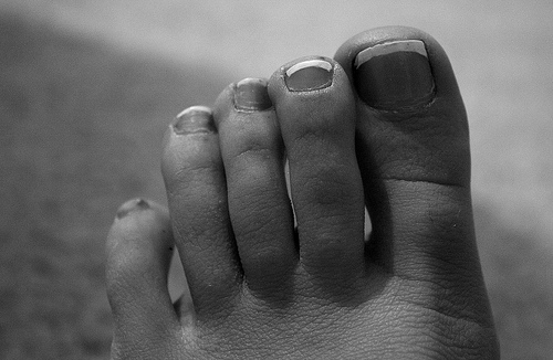 ¿Cómo saber tu estado de salud a través de los pies?