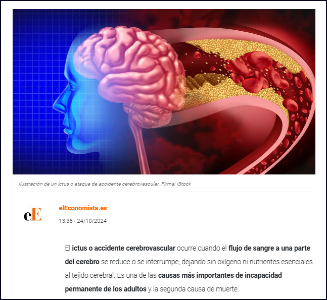 Aumentan los casos de ictus: síntomas y cómo reducir el riesgo