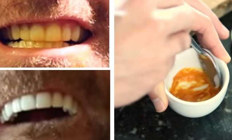 Este hombre muestra un truco de risa para blanquear tus dientes, con pasta y un ingrediente secreto