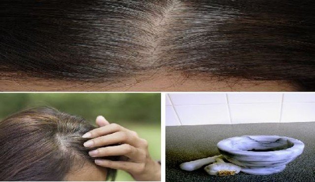 Utiliza esto y en 5 minutos elimina las canas, crece el cabello y evita su caída