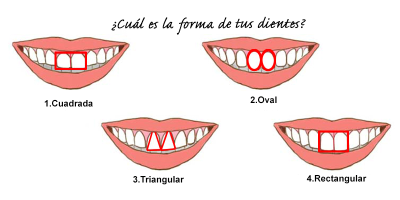 ¿Qué dicen tus dientes sobre tu personalidad? 