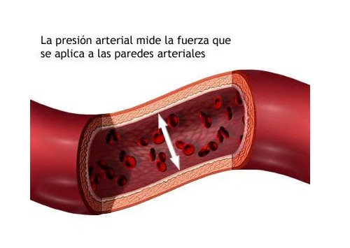 Todo lo que hay que saber sobre la presión arterial alta